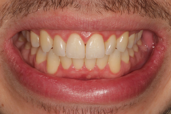 hygienist case after 1