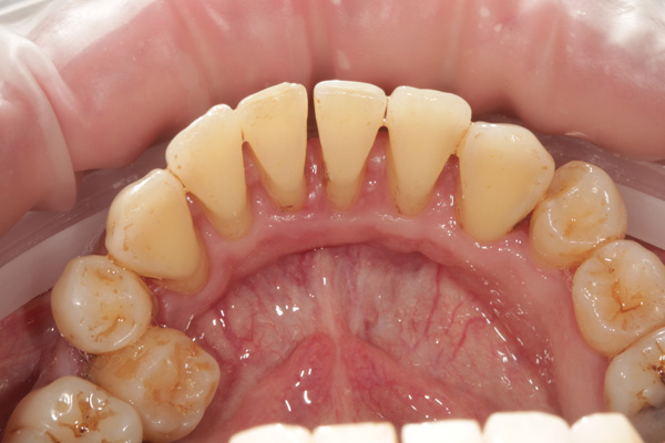 hygienist case after 2