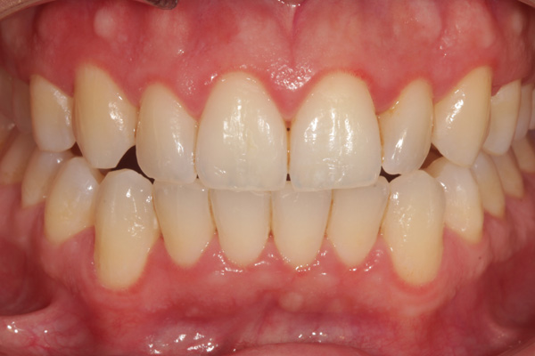 hygienist case after 3