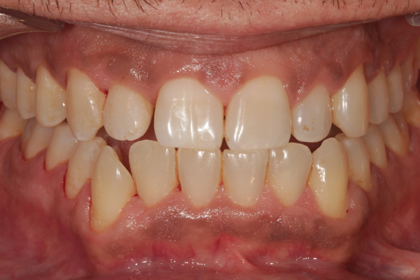 hygienist case after 4