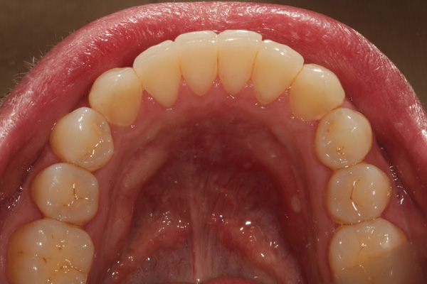 hygienist case after 5