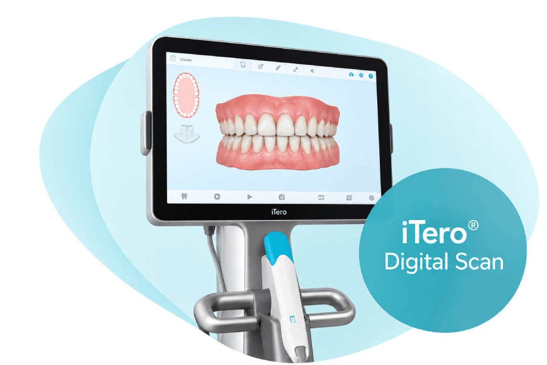 iTero digital scanner showing a 3D scan of teeth